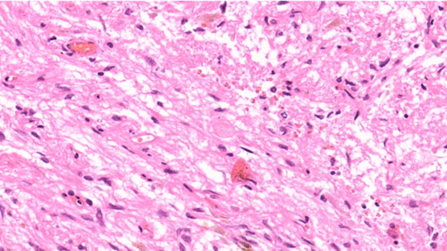 <p>nervous tissue that secretes: ADH and Oxytocin</p>