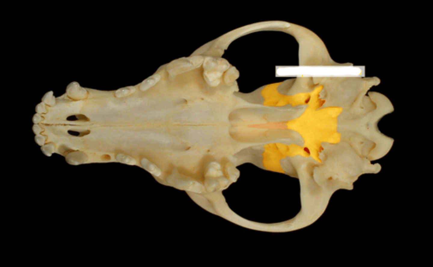 <p>What is the yellow highlighted region?</p>