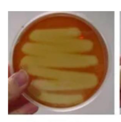 <p>What hemolysis is this?</p>