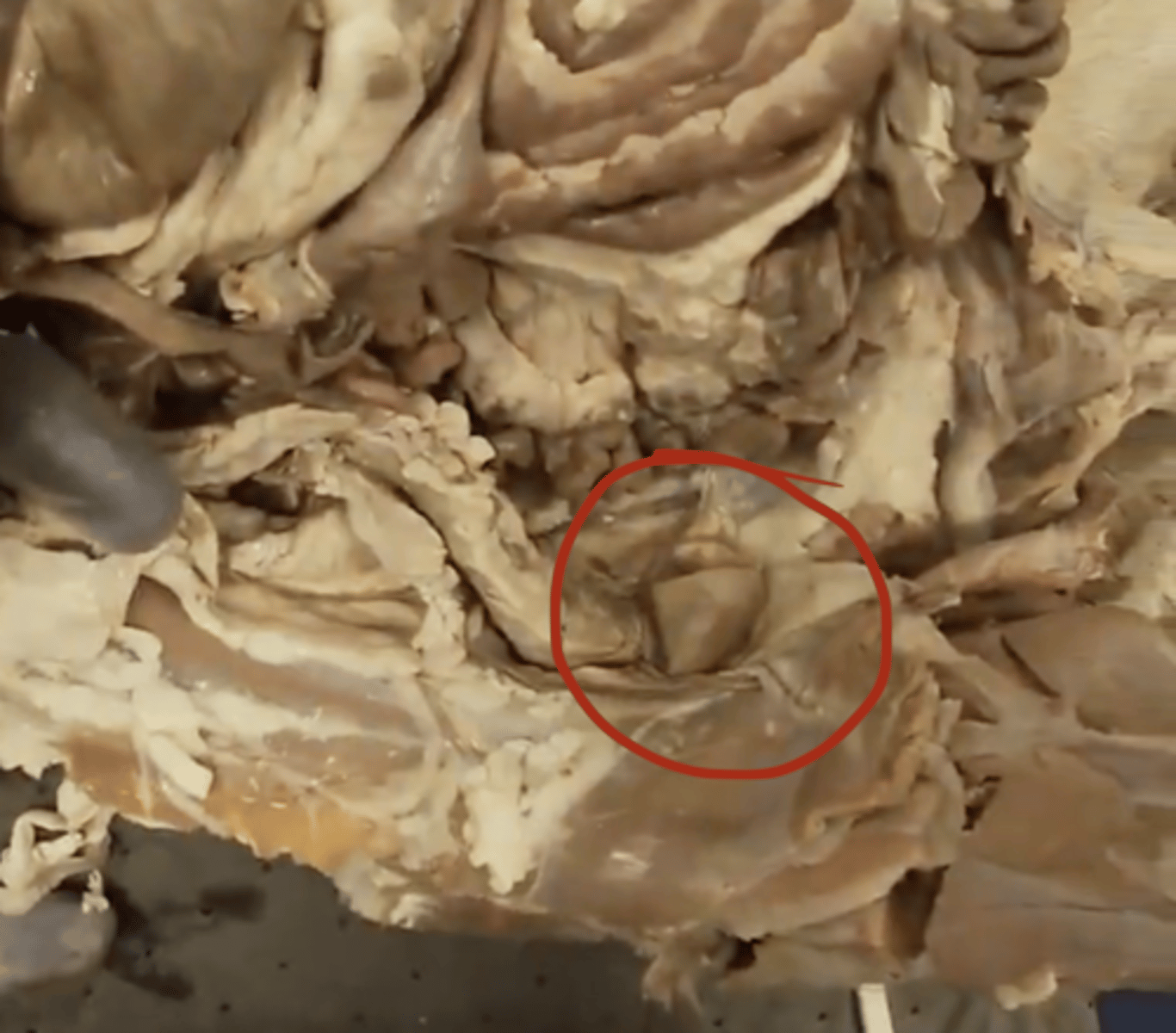 <p>Hollow organ storing urine before excretion.</p>
