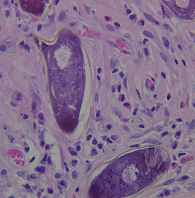 <p>H&amp;E stain of liver tissue</p>