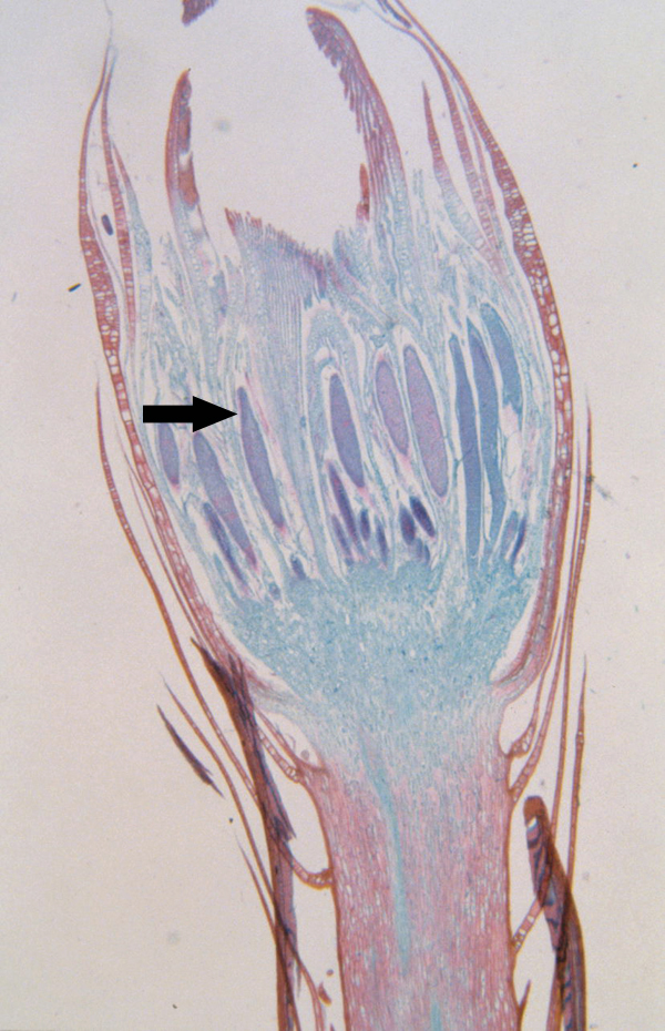 <p>Is this antheridia (male) moss or liverwort</p>