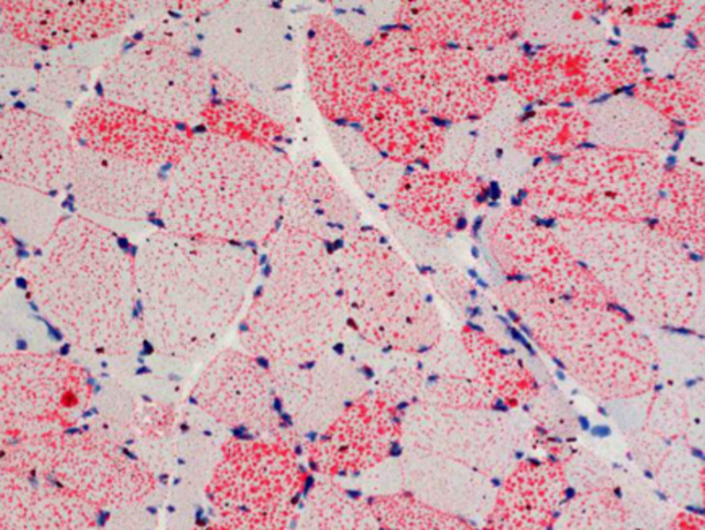 <p>What stains can be used to see steatosis?</p>