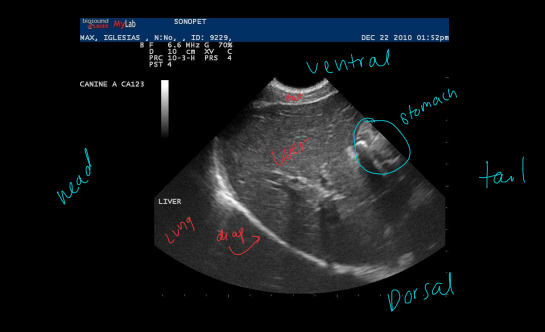 <p>Normal liver on Ultrasound</p>