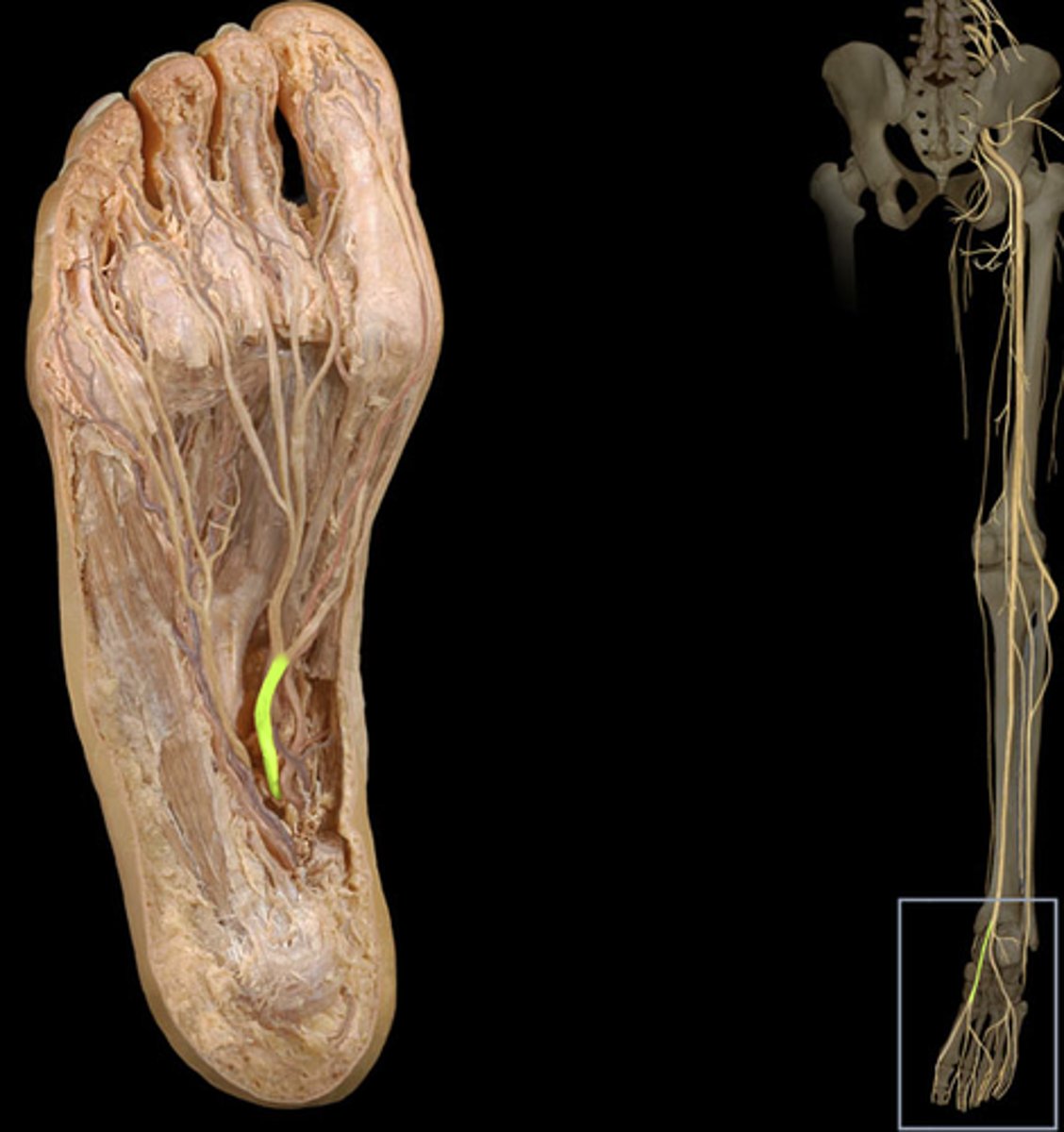 <p>Found above the flexor digitorum brevis, but under the abductor hallucis, both of which it innervates.</p>
