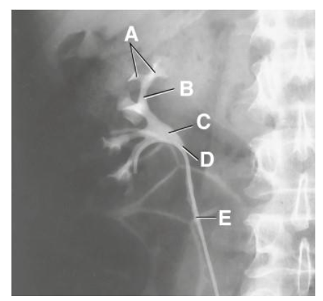 <p>A</p>
