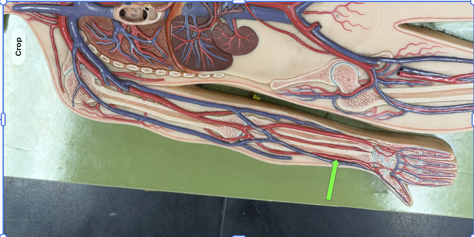 <p>What artery is this </p>