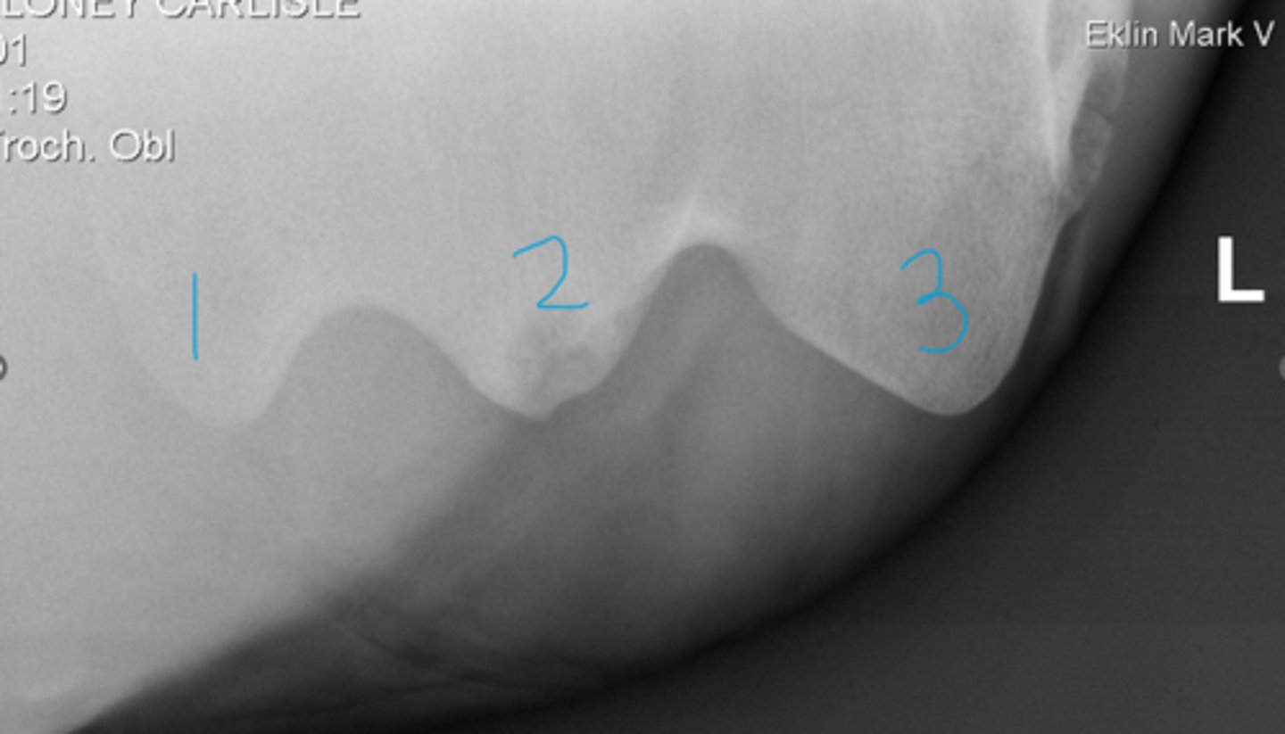 <p>How do you know which limb this is and that 3 is the greater tubercle?</p>