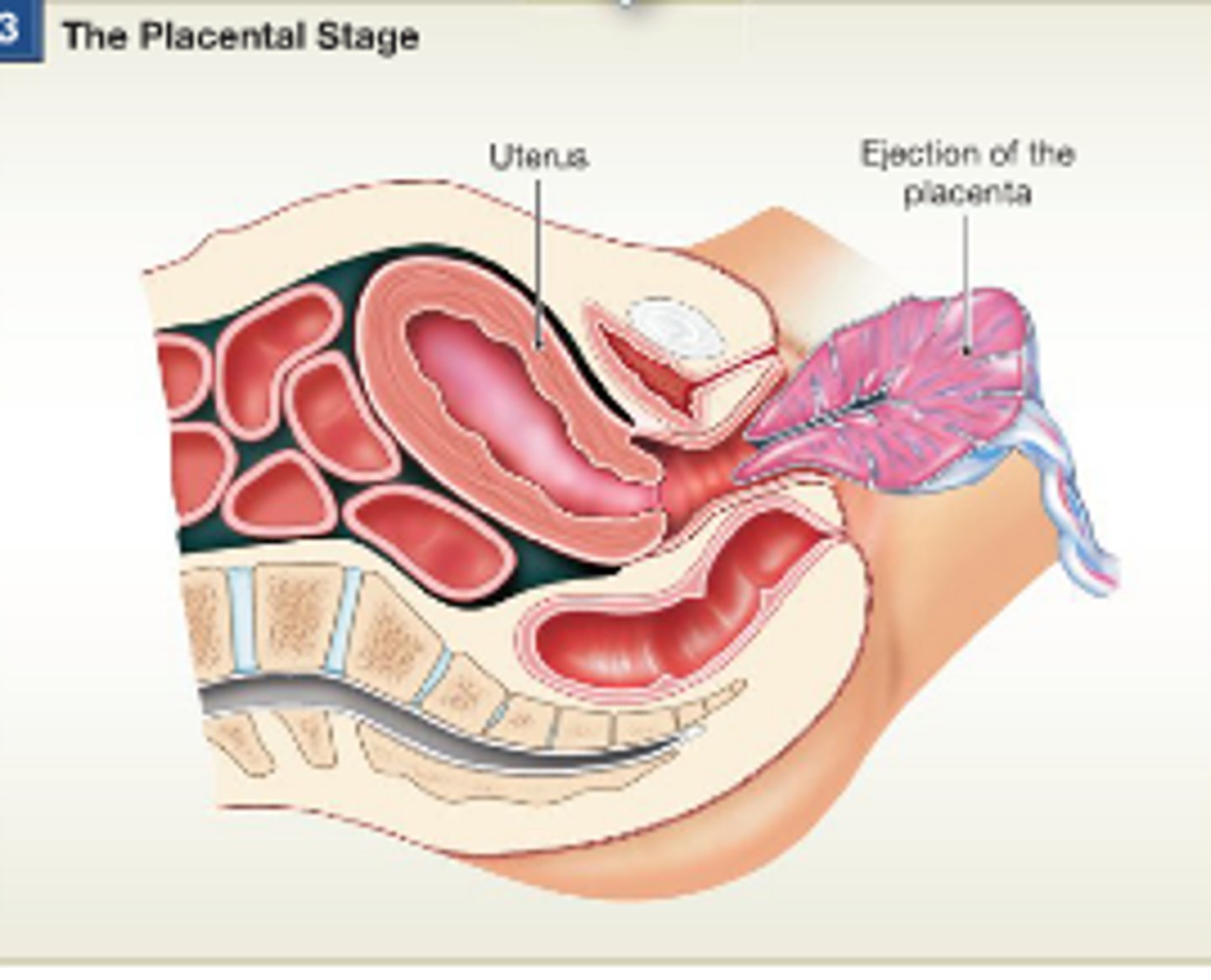 <p>a. Uterine contractions continue causing placental separation</p><p>b. Membranes (afterbirth) inspected to be sure everything has been expelled</p>