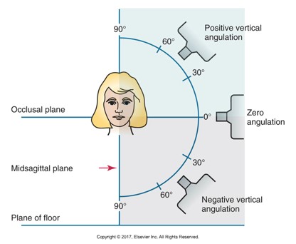 <p>Central ray is directed DOWN</p><p>VA is positive </p>