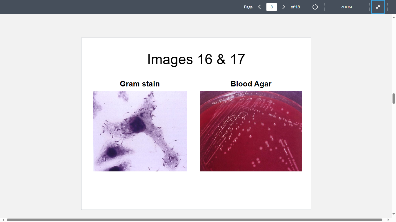 <p>A 27-year-old pregnant woman has developed meningitis shortly after drinking raw milk at her grandparents’ farm. Gram stain of her CSF shows these organisms (Image 16). Culture of the CSF yields an isolate (Image 17) that produces barely noticeable beta- hemolysis. The isolate is most likely to be</p>