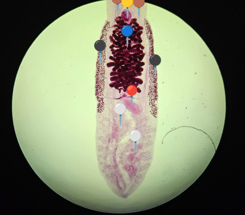 <p><span data-name="worm" data-type="emoji">🪱</span><span data-name="china" data-type="emoji">🇨🇳</span><span><span> </span></span><strong><em>Clonorchis sinensis </em></strong><sub>(Postać dojrzała)</sub></p><p></p><p></p><p><span>🧩🦠 </span><strong>Organelle:</strong></p><p></p><ul><li><p><span>🟡 - przyssawka brzuszna;</span></p></li></ul><p></p><ul><li><p><span>🔵 - macica z jajami;</span></p></li></ul><p></p><ul><li><p><span>⚫️ - żółtniki;</span></p></li></ul><p></p><ul><li><p><span>🔴 - jajnik;</span></p></li></ul><p></p><ul><li><p><span>⚪ - jądra.</span></p></li></ul><p></p><p></p><p><span>😷❓ </span><strong>Parazytoza:</strong><em> Klonorchoza</em></p>