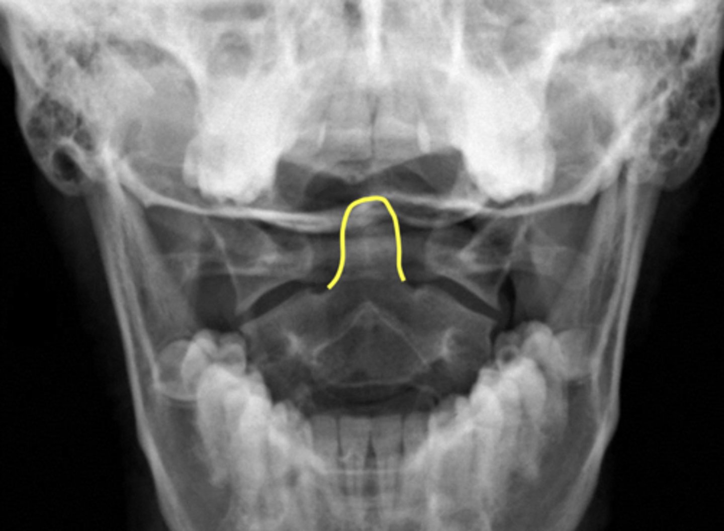 <p>What is outlined in yellow?</p>