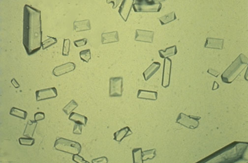 <p>Form in alkaline urine</p><p>Presence is insignificant</p><p>Seen in dog urine specimens with UTIs</p>