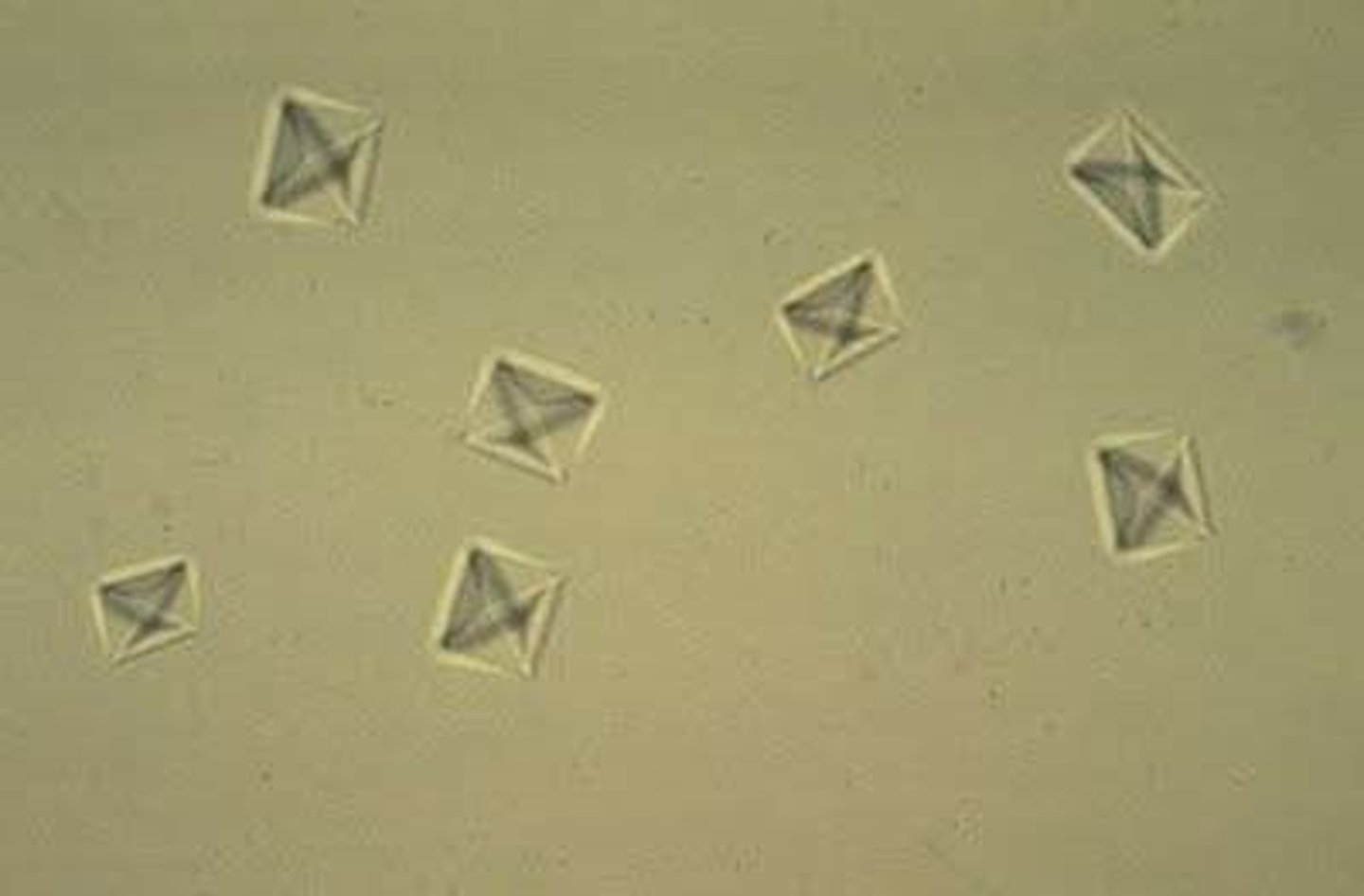 <p>What is being shown histologically?</p>