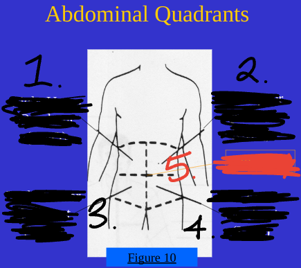 <p>Abdominal Quadrants 1</p>