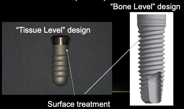 <ul><li><p>“Tissue level” design</p></li><li><p>“Bone level” design</p></li></ul><p></p>