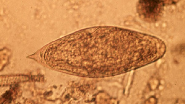 <p>in human urine</p><p>hematuria, cercarial dermatitis, eosinophilia</p><p>history of long term water exposure</p><p>Africa, Middle East</p>