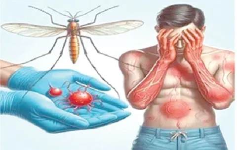 <p>caused by: Flavivirus Dengue virus ( DENV) </p><p>Vector : aedes Egyptian mosquitoes </p><ul><li><p>sever dengas uses antibodies enhancement  ( high jacking antibodies to gain access to the host cell ) </p></li><li><p>vaccine is available but not give to people who have never had the infection </p></li></ul><p></p>