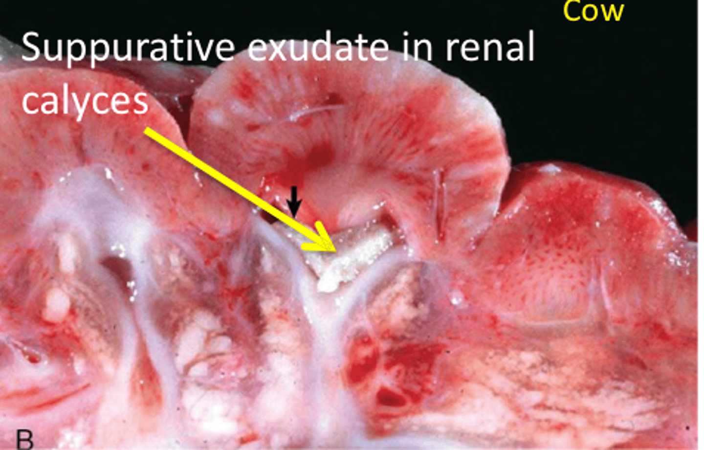<p>Bacterial infection of the renal pelvis with extension into the tubules and interstitium</p><p>Most common in sows &amp; cows</p><p>Associated with parturition, service, &amp; catheter use</p>