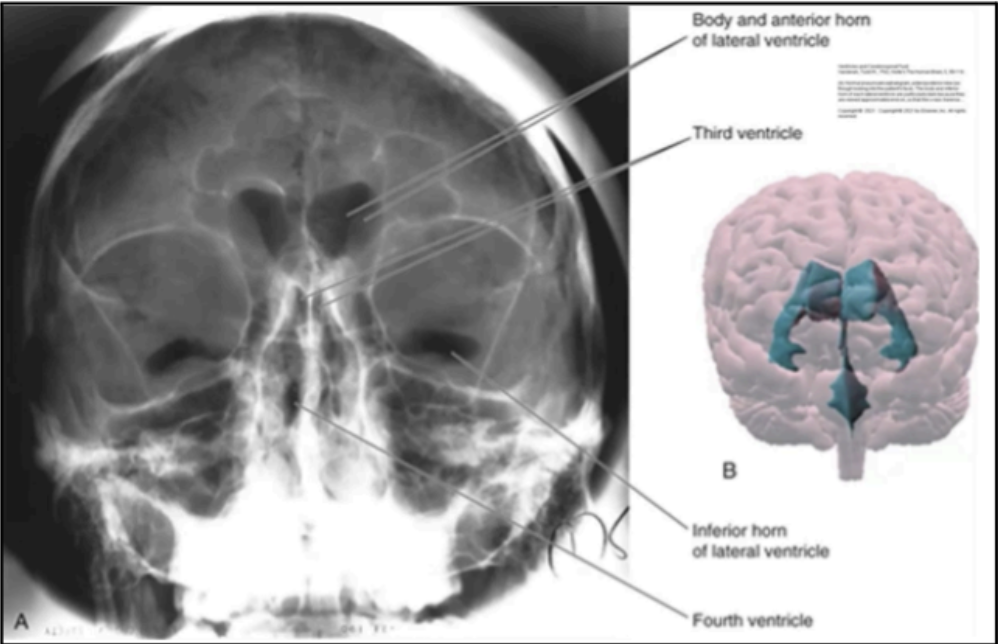 <p>Location: Temporal Lobe</p>