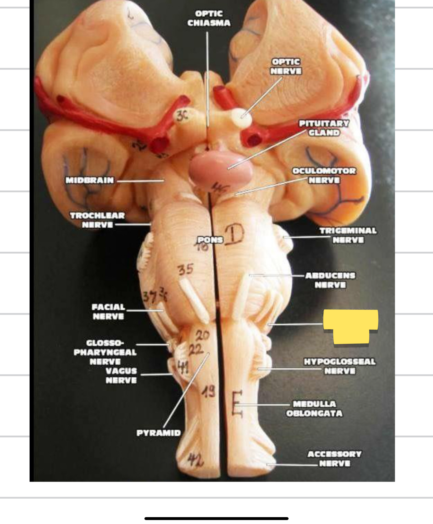 <p>Name this cranial nerve&nbsp;</p>
