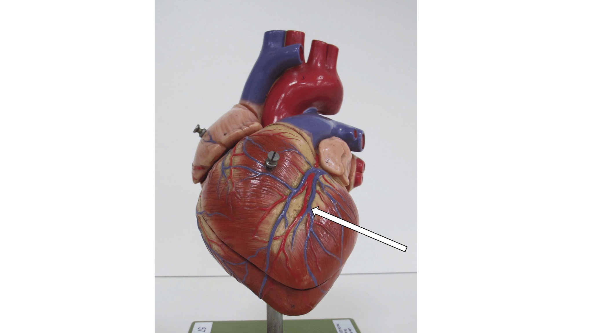 <p>aftakking van vena cardiaca magna</p>