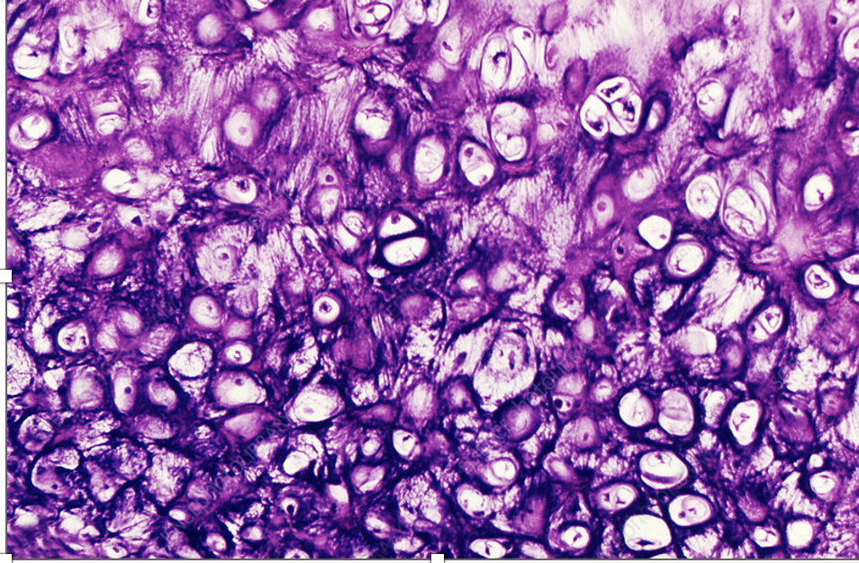 <ul><li><p>consists of elastic and collagen fibres </p></li><li><p>not as closely packed together like hyaline cartilage</p></li><li><p>provides:</p><ul><li><p>flexible, elastic support</p></li></ul></li><li><p>Found in external ear and epiglottis provides:</p></li></ul><p></p>