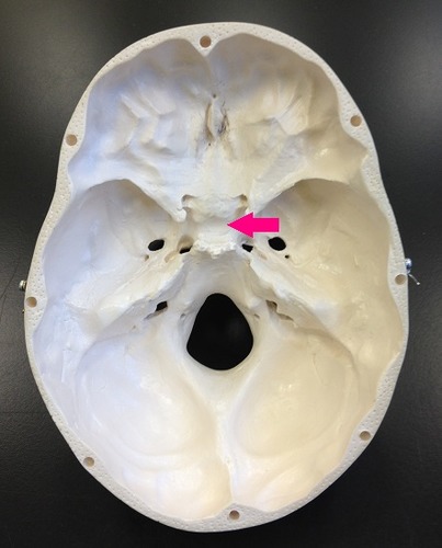 <p>Identify the structure.</p>