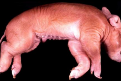 <p>Hyperostose corticale congénitale </p>