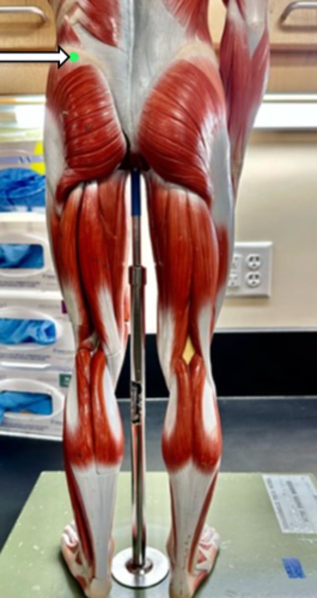 <p>gluteus medius (function)</p>