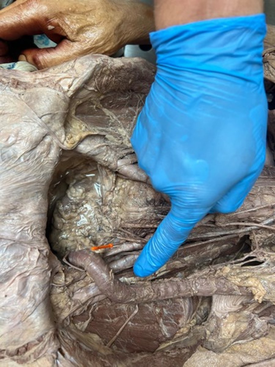 <p>internal iliac artery</p>