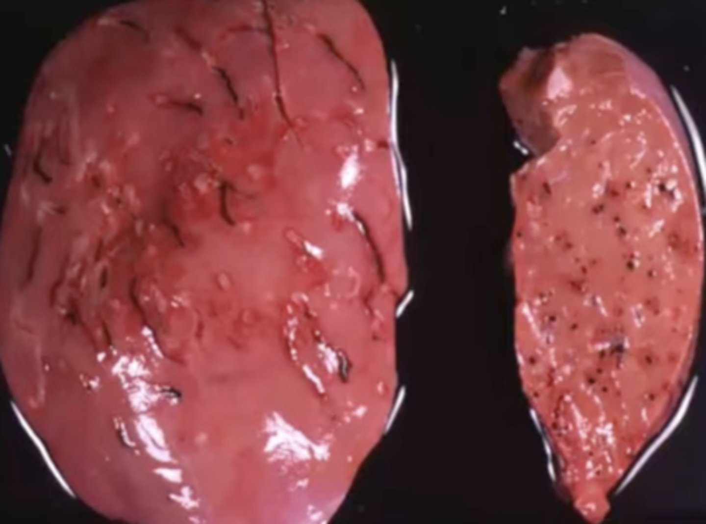 <p>What has caused this gross appearance of this sheep liver?</p>