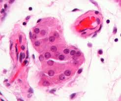 <p>in the testes, secrete testosterone and other male sex hormones</p>