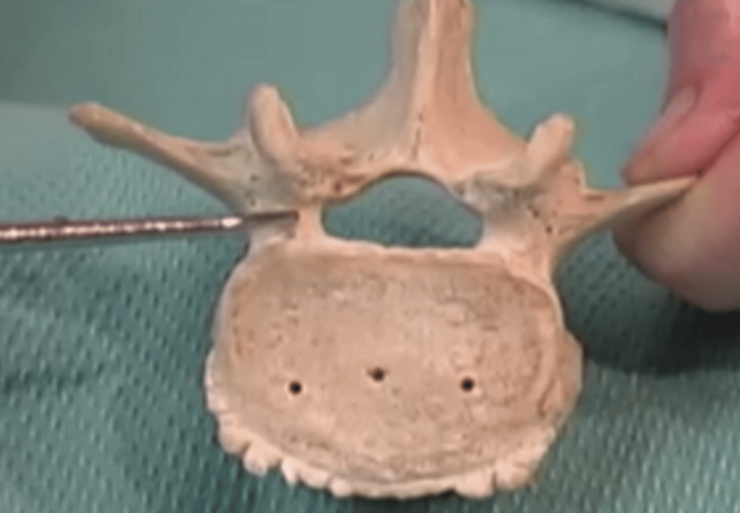 <p>What structure is being shown here?</p><p></p>