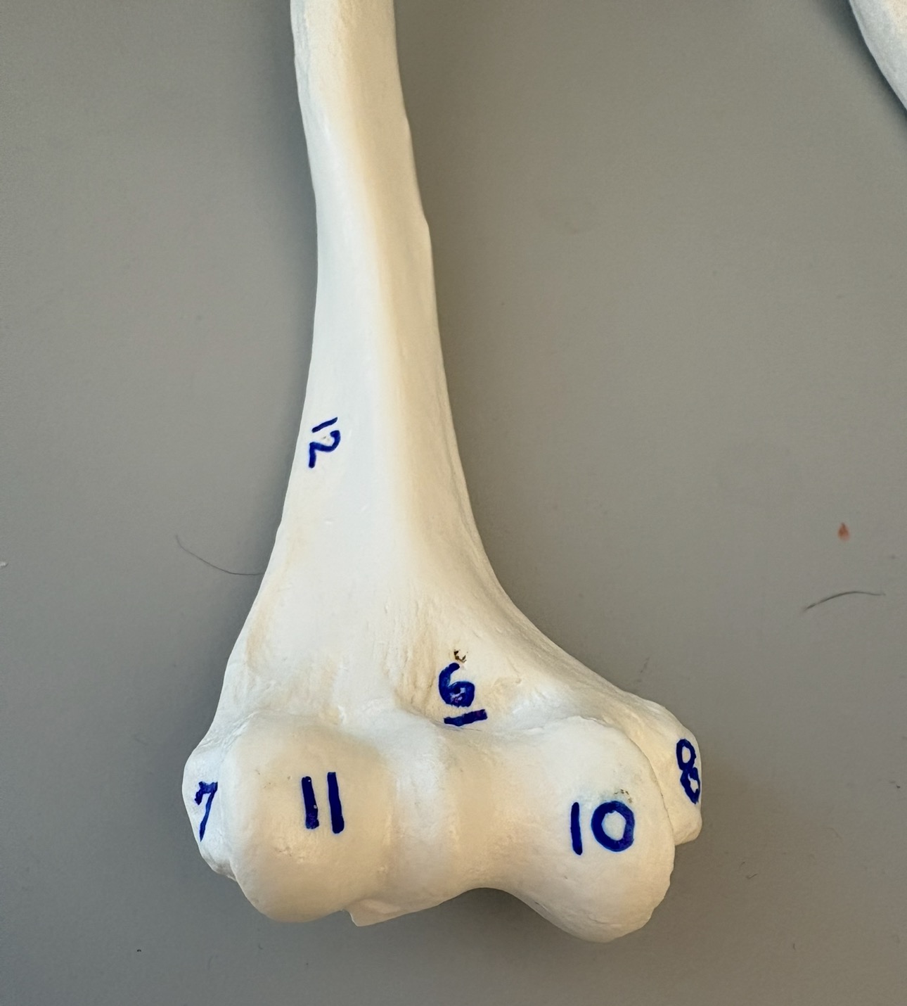 <p>what is 12?</p>