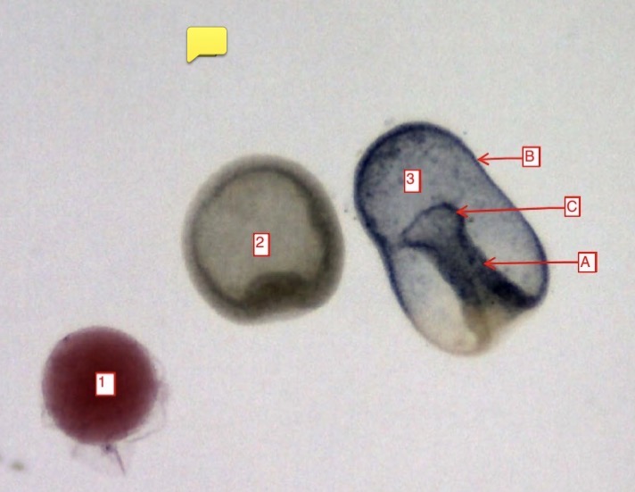<p>starfish development stages- (C)</p>
