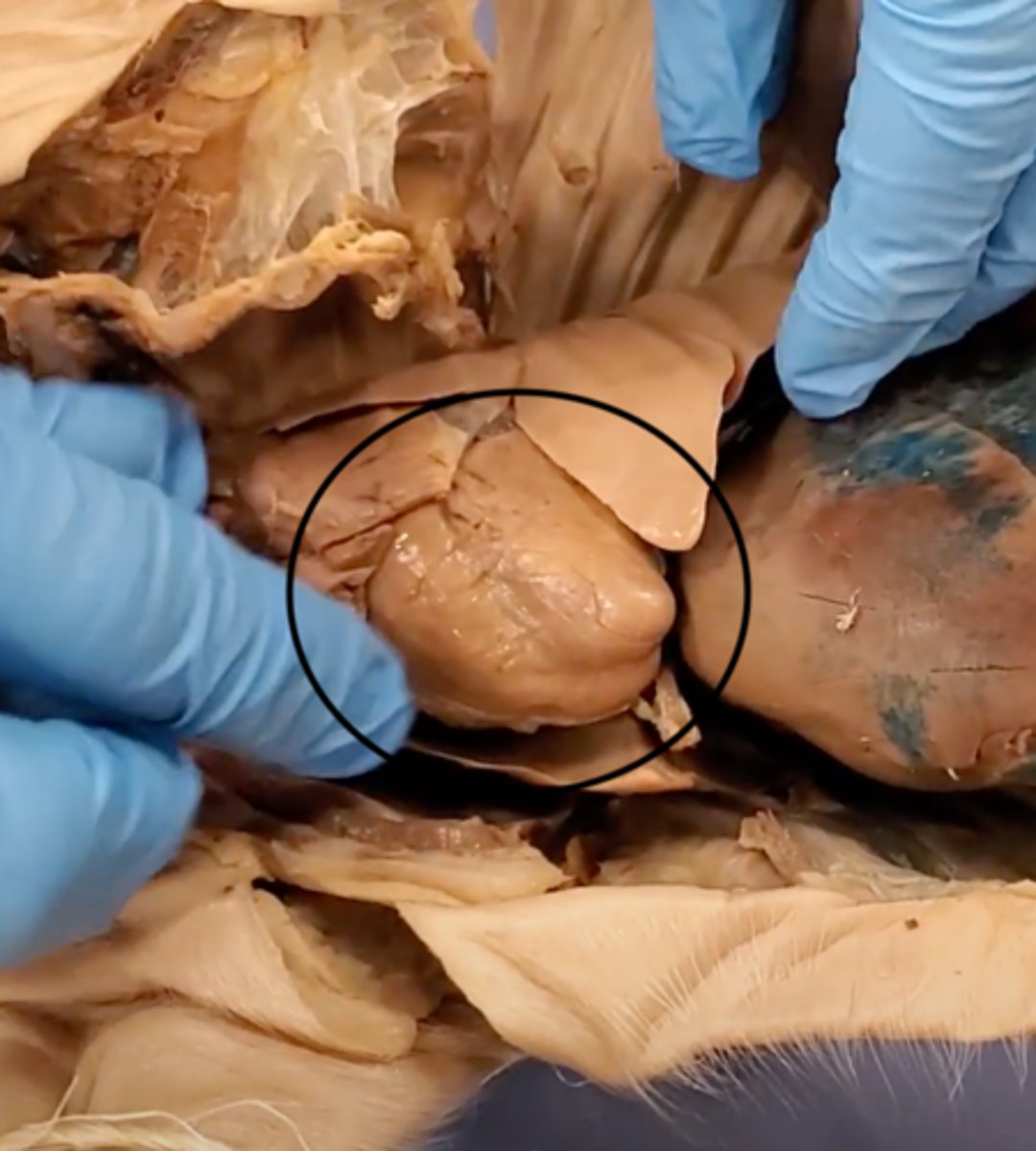 <p>A hollow, muscular organ that pumps blood throughout the body.</p>
