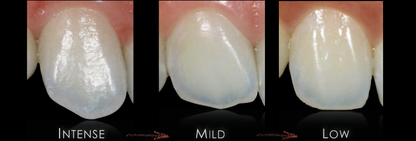 <p>light reflection</p>