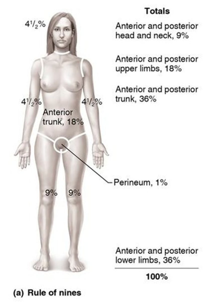 <p>Critical if &gt;25% body has second degree burns.</p>
