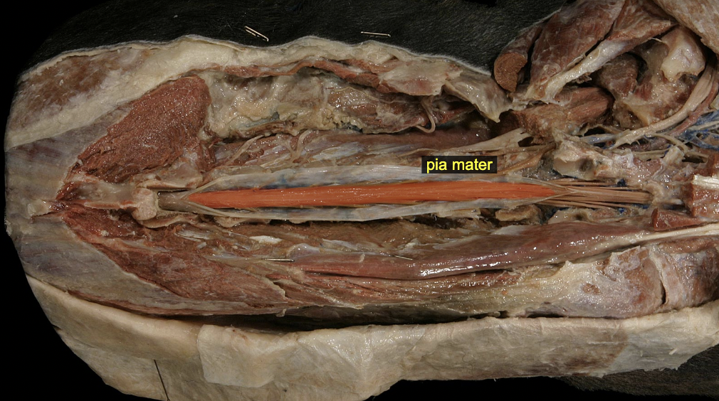 <p>Pia mater: denticulate ligament</p>