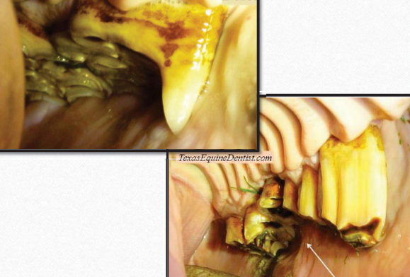 <p>What dental abnormalities are shown?</p>