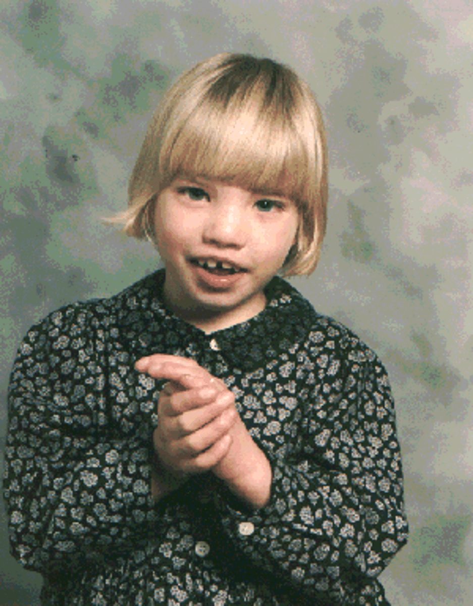 <p>rare chromosomal disorder due to loss of material from 5p</p><p>- initially present with hypotonia</p><p>- facial abnormalities</p><p>- minor UE abnormalities</p><p>- scoliosis/congenital heart disease is common</p><p>*high pitched cry (like a kitten)</p>