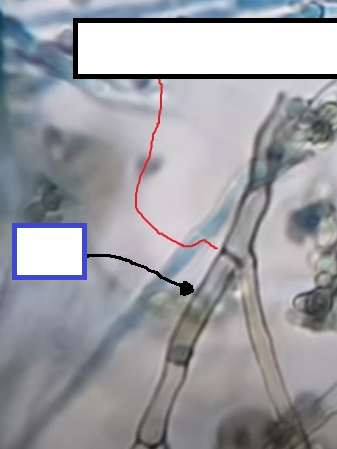 <p>What is the blue box referring to?</p>