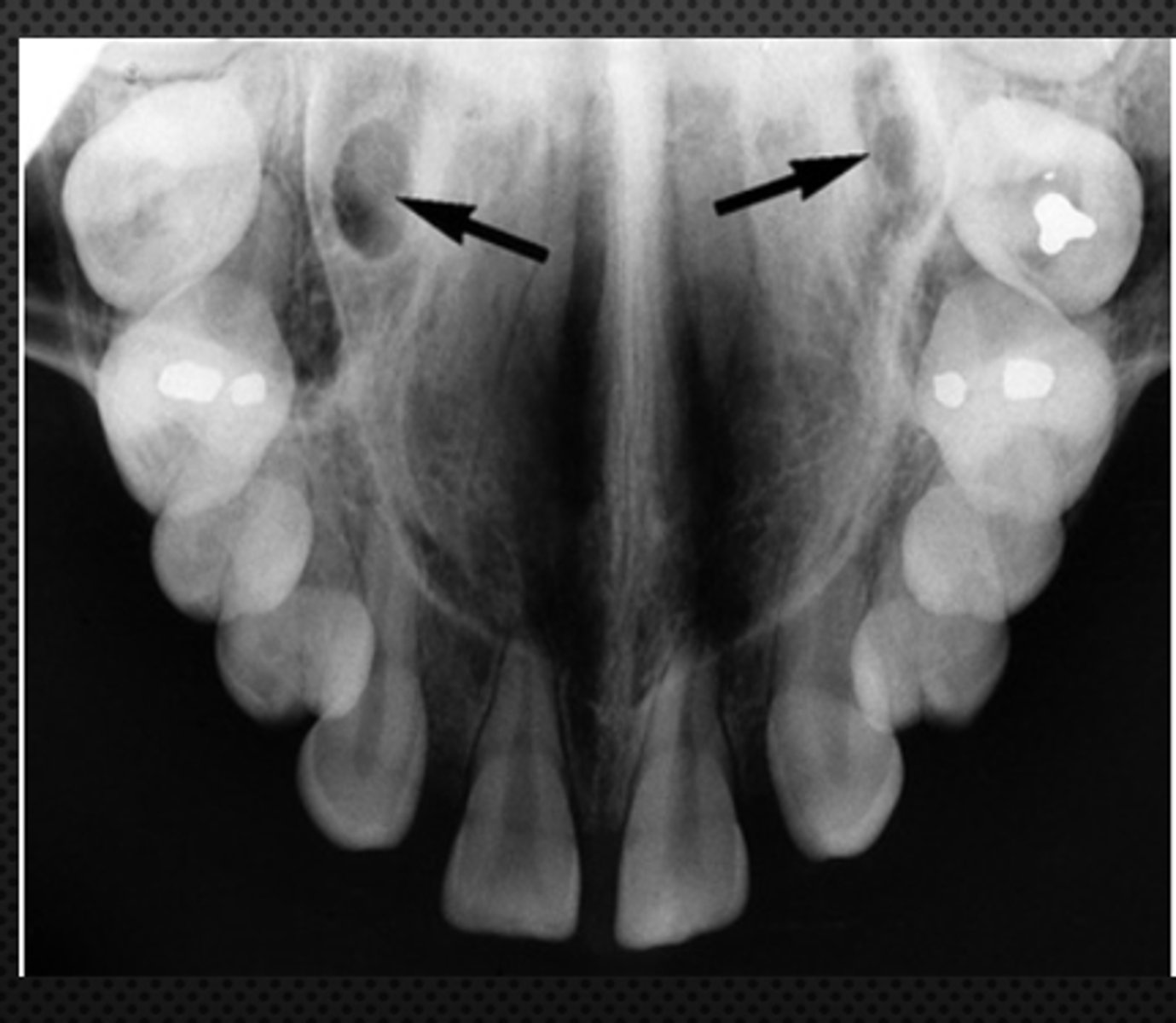 <p>Name the structure the black arrow is pointing to.</p>
