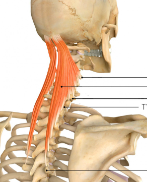 <p>Semispinalis Capitis</p>