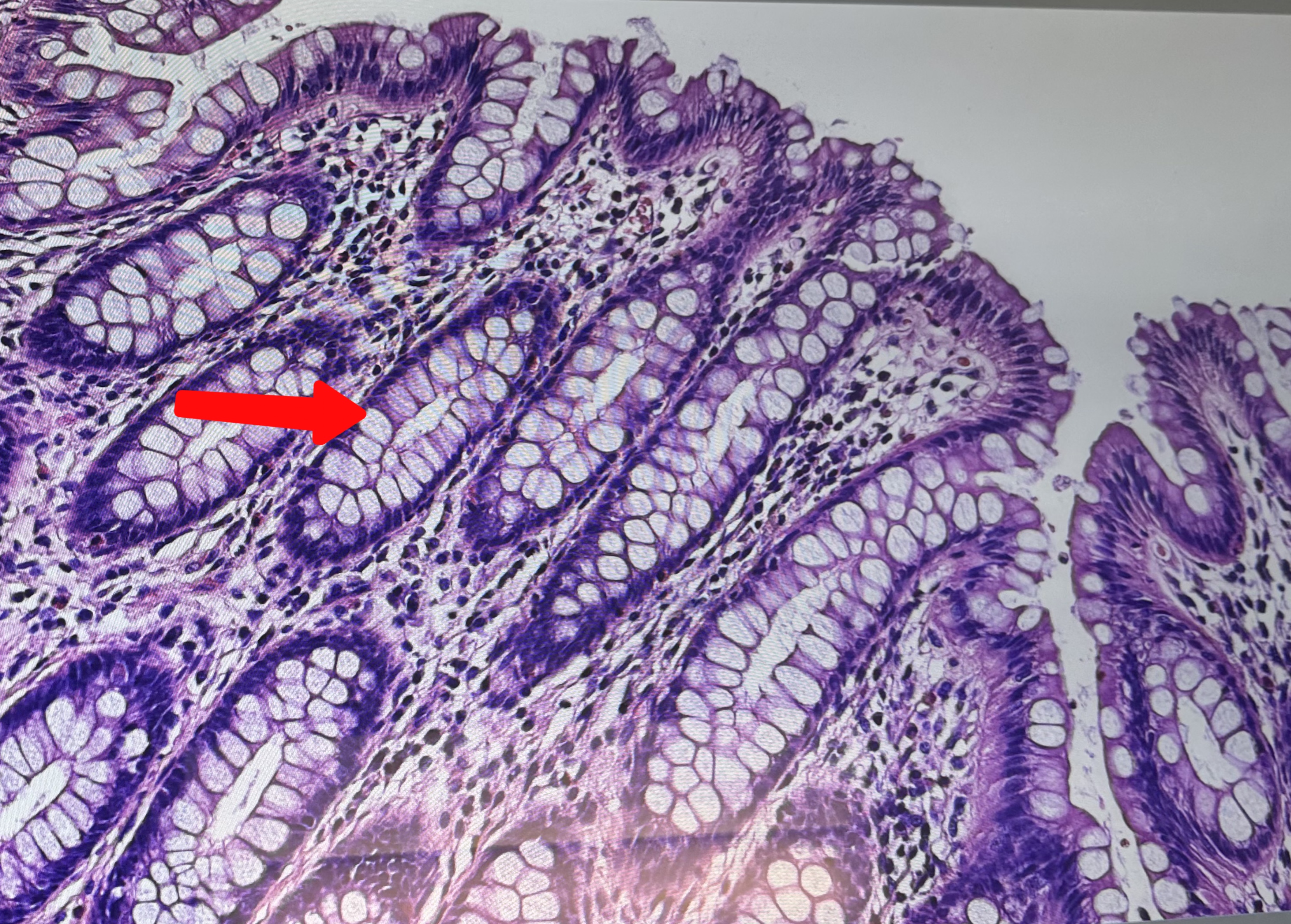 <p>Colon: LOTS of goblet cells, why? </p>