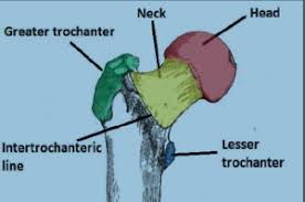<p>line on the anterior (opposite to the greater trochanter) </p>