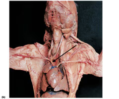 <p>What is the arrow pointing to? What’s it function? </p>