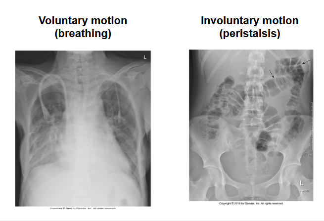 <p>What does the left image and right image show</p>